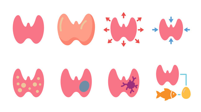 Set of human thyroid gland icons showing health conditions, medical symptoms, swelling, nodule and disease diagnosis, endocrine system anatomy