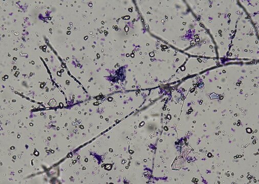 soil microorganisms under a microscope including amoeba, flagellates, nematodes, fungi, bacteria	