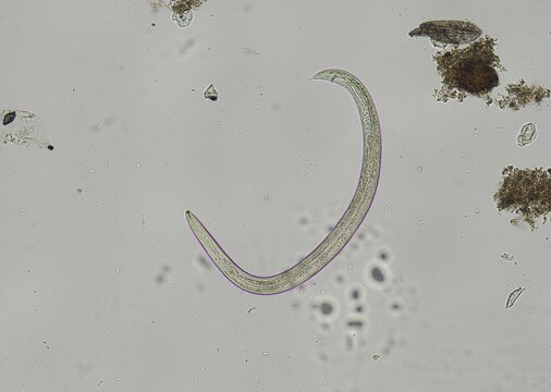 detailed high-magnification micrograph (brightfield microscopy) showing a single, curved parasitic nematode, likely a rhabditiform larva, isolated from a soil or fecal sample. The internal anatomy