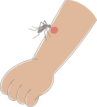 Mosquito Biting Human Arm With Red Bite Mark Flat Illustration