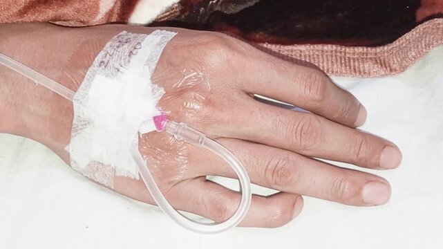 The back of the hand (dorsal venous network) is often chosen as the site for IV needle insertion because the veins are close to the skin's surface, ensuring smooth fluid flow and patient comfort.