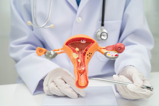 Doctor holding human uterus model for vaginal and cervix pap smear check up in the obstetrics and gynecology.