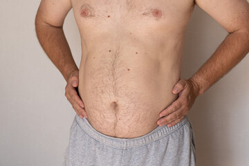 Naklejka premium Overweight Male Belly with Bloating and Abdominal Obesity Concep