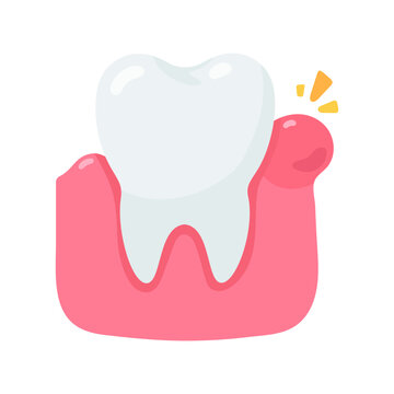 Close up of a cartoon tooth with inflamed red gum, symbolizing gingivitis and common oral health issues