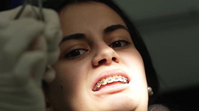 Young woman receiving braces installation at orthodontist clinic