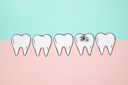 Teeth, caries, inflammation or acute pain, toothache, cavity tooth issue, dental extraction, bacterial periodontitis