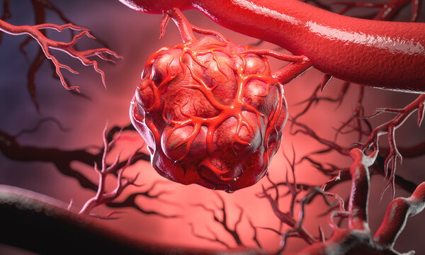 A magnified view of cancer cells within a blood vessel, surrounded by pathogens 3d illustration.