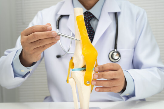 Osteoarthritis of the knee, Doctor holding human knee joint orthopedic anatomy model in hospital.