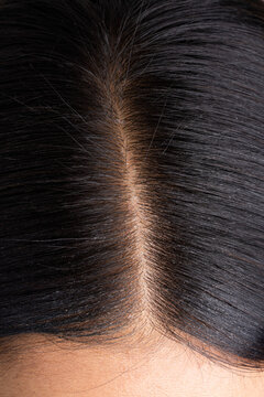 Detailed macro close-up of clean human hair parting and hair follicles on scalp
