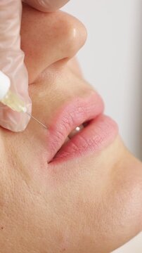 Close up view of a beautician's hands in gloves making a cosmetic injection in a woman's lips, augmenting and contouring them with hyaluronic acid filler for rejuvenation and enhancement