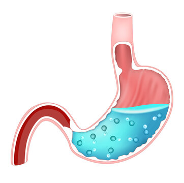 Gastric acid anatomy. Cross section of human stomach and molecule HCl hydrochloric acid. Gastric juice.