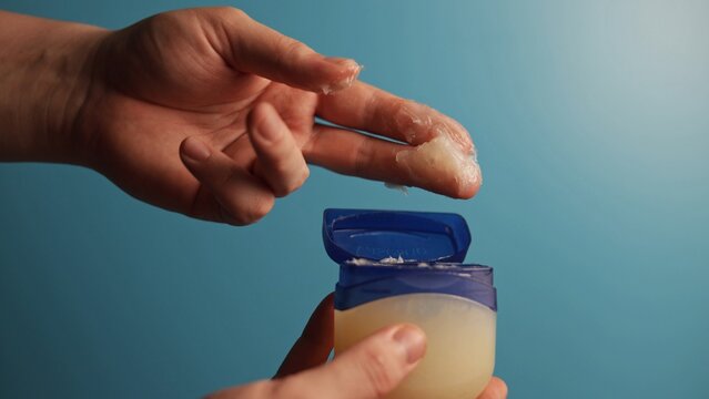 Applying petroleum jelly from a small blue and white container to fingers