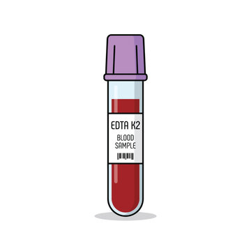 Medical blood collection tube with purple cap for hematology analysis and laboratory testing.