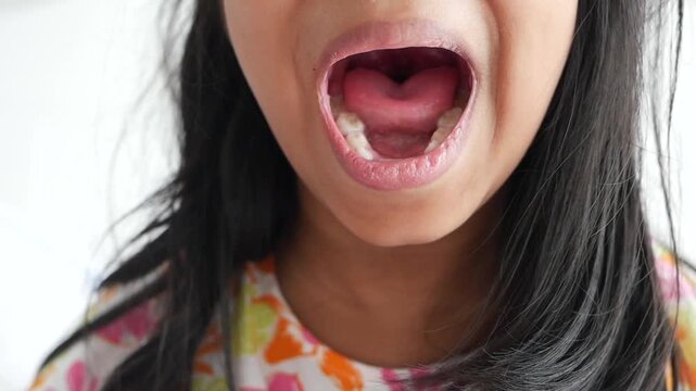 Close up video of little asian girl showing her two missing upper front milk teeth in her mouth
