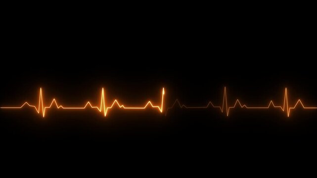 Bright heart rhythm background 4K heartbeat monitor EKG line monitor shows heartbeat ,EKG machine at veterinary clinic during surgery, heartbeat on screen, Motion graphics of