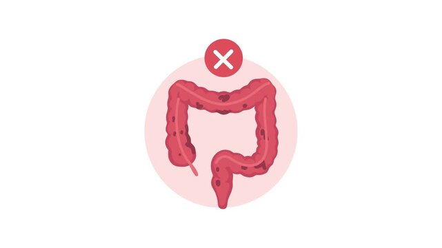 animation of inflamed colon disease concept