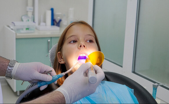 Pediatric dentist using UV curing light lamp on tooth filling for young girl