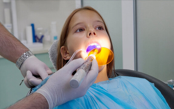 Pediatric dentist using UV curing light lamp on tooth filling for young girl