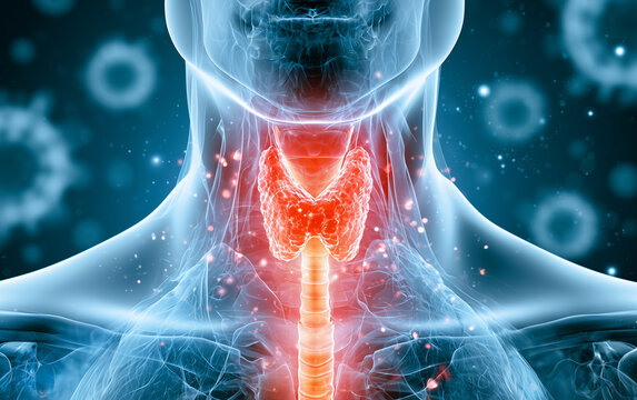 Medical 3D render of human neck anatomy inflamed thyroid gland. Immune system cells attack endocrine organ in body causing Hashimoto disease.