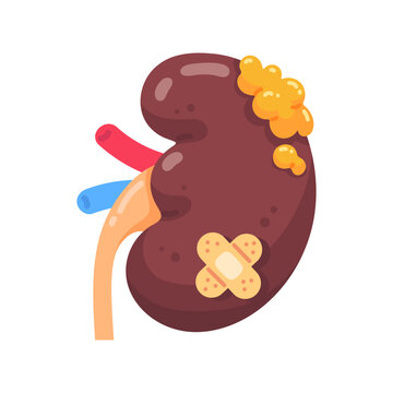 Vibrant cartoon kidney illustration depicting health challenges with a growth and a healing bandage
