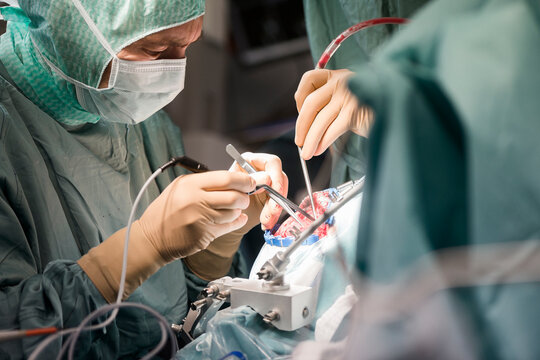 Neurosurgeons opening the cranium during an operation