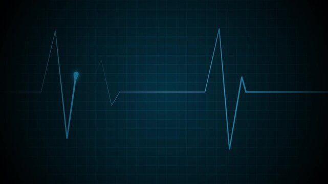 Heartbeat monitor line on a grid with a flat pulse and sharp spikes animation, showing a medical emergency or heartbeat concept
