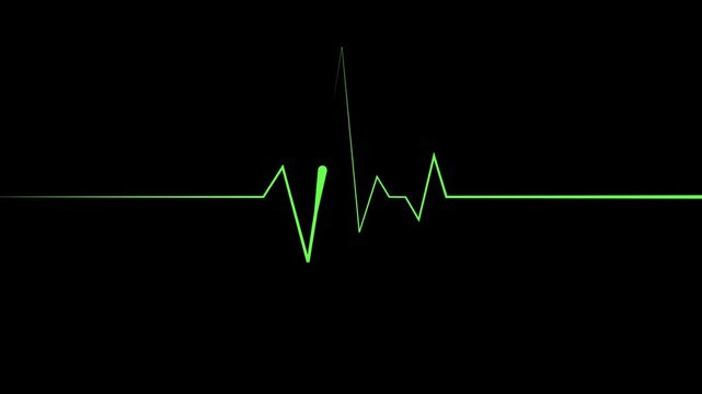Heartbeat line pulse spike and flat line emergency monitoring animation
