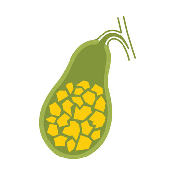 Gallbladder with stones vector illustration showing cholelithiasis medical concept