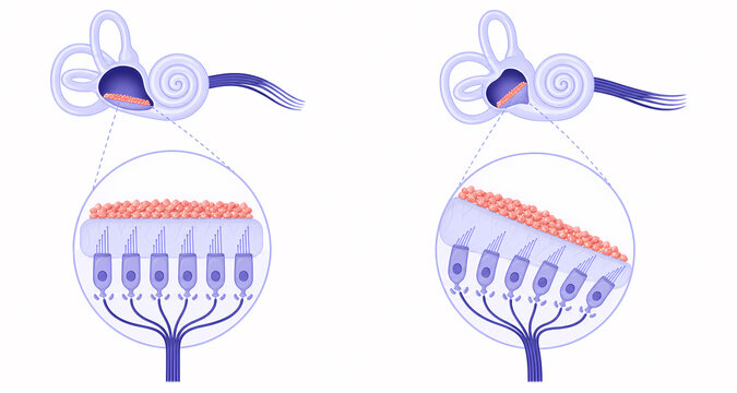 Otolith gravity sensing vestibular illustration