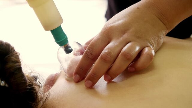 Professional therapist removes air from massage cup before cupping treatment on upper back. Vacuum therapy stimulates blood flow and promotes deep relaxation.