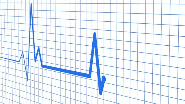 Cardiology Monitor Animation Featuring Heart Rate Wave Signal