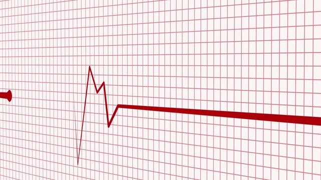 Medical Heart Rate Signal Animation with Pulse Monitoring Display