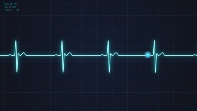 Digital heartbeat monitor graphic showing medical electrocardiogram wave rhythm on dark screen.