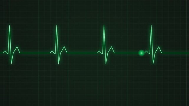 Ekg heart monitor shows normal sinus rhythm on a dark green screen with grid lines for medical and healthcare concepts.