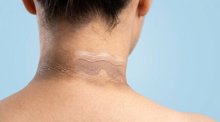 Naklejka premium Close-up of darkened skin folds on the back of a human neck with a 3D anatomical cross-section illustration