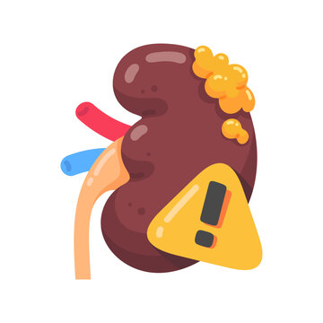 Stylized graphic of human kidney indicating health problems and an important disease warning