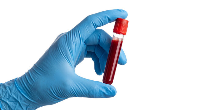 Close up of gloved hand holding medical blood test tube with red liquid, representing healthcare and scientific research, lab analysis sample.