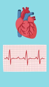 Animation of electrocardiogram for heart diagnosis