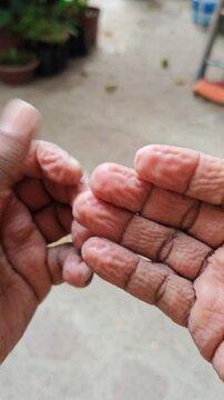 Close Up of Wrinkled Finger Skin from Prolonged Water Exposure