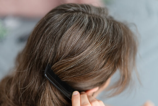 A woman experiences multiple hair disorders including graying and thinning together. The mature adult seeks solutions for her aging hair problems. Mother consults experts about silver strand issues.