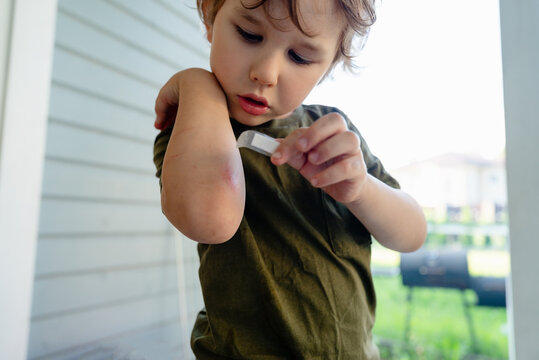 A brave little boy stands in a domestic setting, applying a bandage to his elbow after a fall. This independent child shows resilience while practicing self-care in a bright living room.