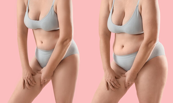 Woman's body before and after weight loss, comparison of body shape and skin texture, isolated on a pink background