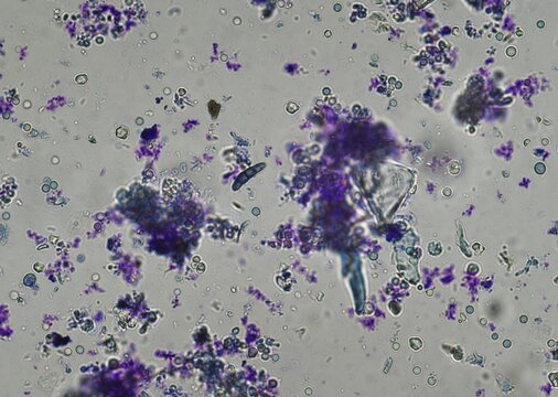 soil microorganisms under a microscope including amoeba, flagellates, nematodes, fungi, bacteria	