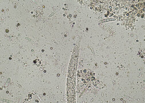 soil microorganisms under a microscope including amoeba, flagellates, nematodes, fungi, bacteria	