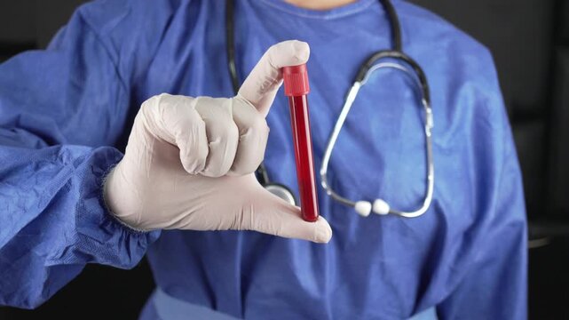 Healthcare worker in blue scrubs and stethoscope holds a red-capped blood sample tube toward the camera, useful for medical, lab, or diagnostic themes.