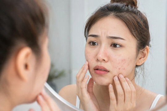 Asian young woman looking in mirror worrying about acne skin problem and facial skincare condition