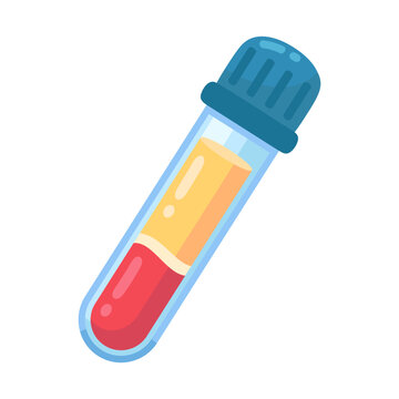 Vital Blood Sample Analysis in a Laboratory Test Tube, Revealing Distinct Red Cell and Plasma Layers