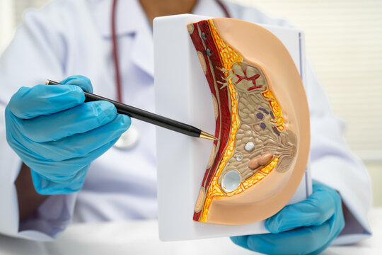 doctor holding female breast human anatomy model.