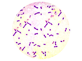 Obraz premium Gram positive Streptococcus pneumoniae or pneumococci analyzed by light microscope.