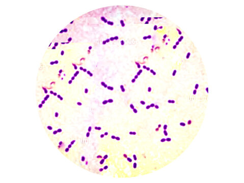 Gram positive Streptococcus pneumoniae or  pneumococci analyzed by light microscope.